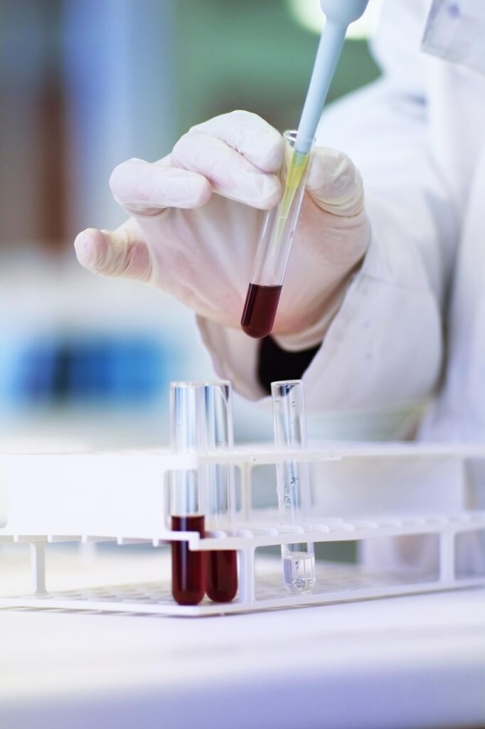 science, scientist, test tube, transfer, biology, biologist, laboratory, scientist, scientist, laboratory, laboratory, laboratory, laboratory, laboratory